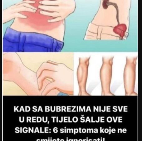 KADA SA BUBREZIMA NIJE SVE U REDU, TELO ŠALJE OVE SIGNALE: 6 simptoma koje ne smete ignorisati!