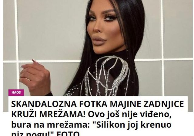 SKANDALOZNA FOTKA MAJINE ZADNJICE KRUŽI MREŽAMA! Ovo još nije viđeno, bura na mrežama: “Silikon joj krenuo niz nogu!” FOTO