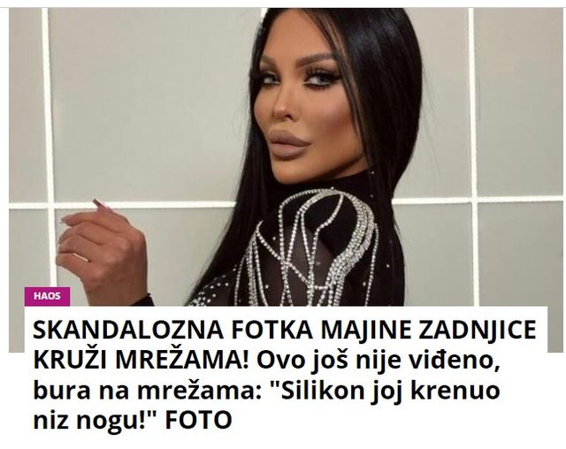 SKANDALOZNA FOTKA MAJINE ZADNJICE KRUŽI MREŽAMA! Ovo još nije viđeno, bura na mrežama: “Silikon joj krenuo niz nogu!” FOTO