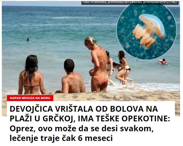 DEVOJČICA VRIŠTALA OD BOLOVA NA PLAŽI U GRČKOJ, IMA TEŠKE OPEKOTINE: Oprez, ovo može da se desi svakom, lečenje traje čak 6 meseci