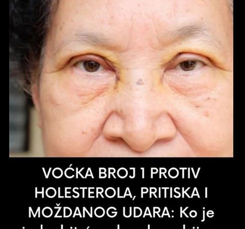 VOĆKA BROJ 1 PROTIV HOLESTEROLA, PRITISKA I MOŽDANOG UDARA: Ko je jede, zdrav je kao dren!