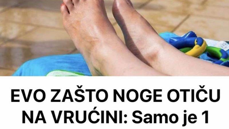 EVO ZAŠTO NOGE OTIČU NA VRUĆINI