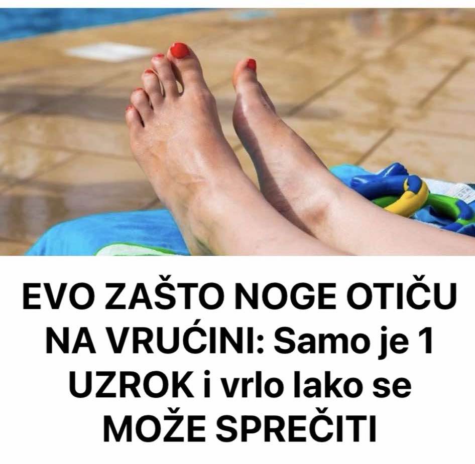 EVO ZAŠTO NOGE OTIČU NA VRUĆINI