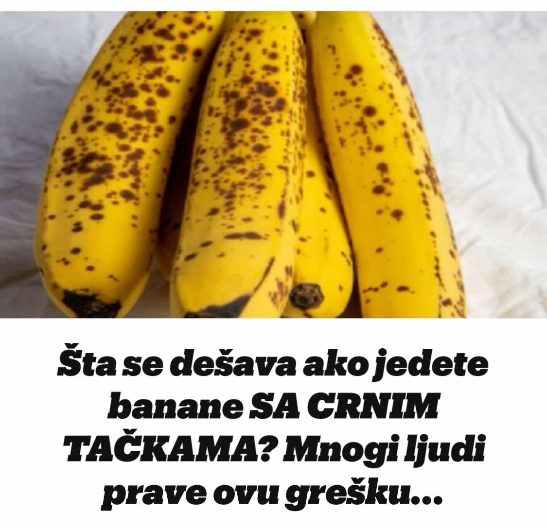 Šta Se Dešava Ako Jedete Banane SA CRNIM TAČKAMA?