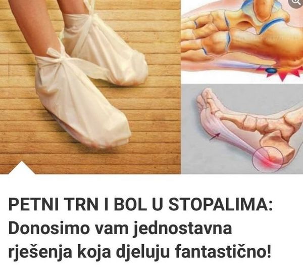 PETNI TRN I BOL U STOPALIMA: Donosimo Vam Jednostavna Rješenja Koja Djeluju Fantastično