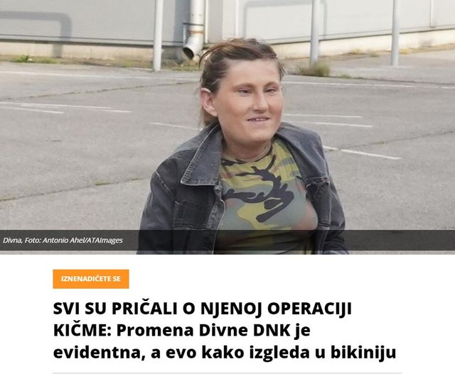 SVI SU PRIČALI O NJENOJ OPERACIJI KIČME: Promena Divne DNK je evidentna, a evo kako izgleda u bikiniju