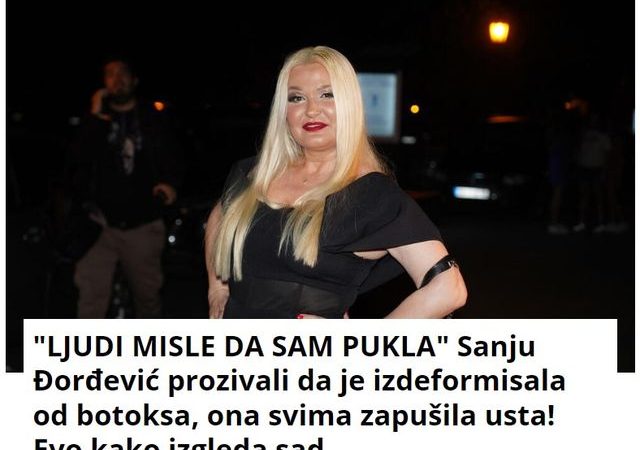 “LJUDI MISLE DA SAM PUKLA” Sanju Đorđević prozivali da je izdeformisala od botoksa, ona svima zapušila usta! Evo kako izgleda sad