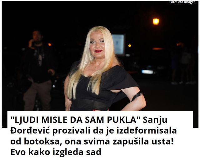 “LJUDI MISLE DA SAM PUKLA” Sanju Đorđević prozivali da je izdeformisala od botoksa, ona svima zapušila usta! Evo kako izgleda sad