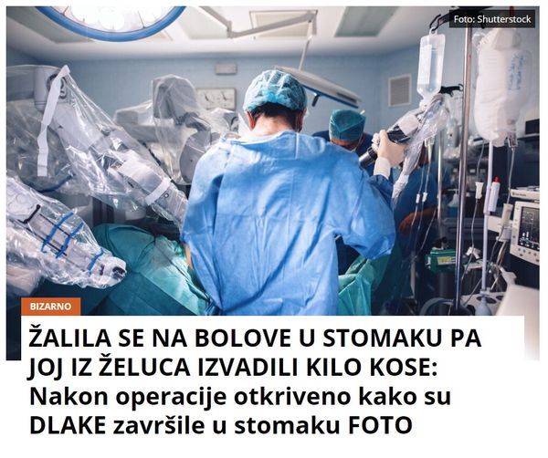 ŽALILA SE NA BOLOVE U STOMAKU PA JOJ IZ ŽELUCA IZVADILI KILO KOSE: Nakon operacije otkriveno kako su DLAKE završile u stomaku FOTO