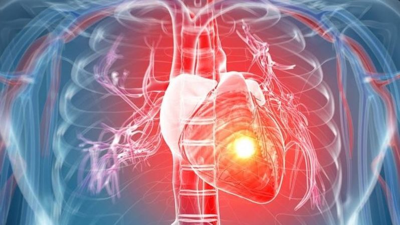 Ne izazivaju infarkt holesterol, trigliceridi ili veliki broj kila, tvrdi čuveni kardiolog: Na 1. mestu ovo razara srce