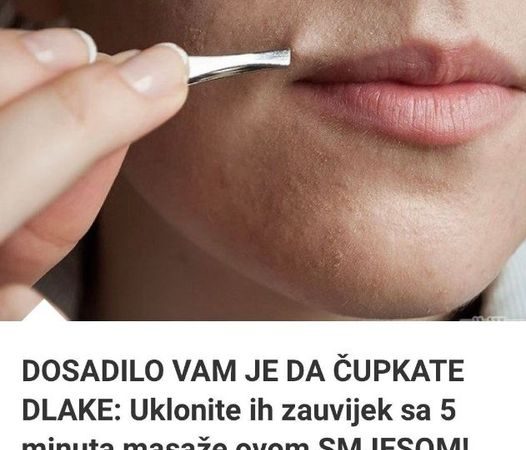 DOSADILO VAM JE DA ČUPKATE DLAKE: Uklonite Ih Zauvijek Sa 5 Minuta Masaže Ovom SMJESOM