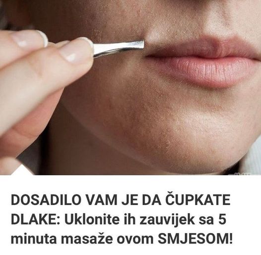 DOSADILO VAM JE DA ČUPKATE DLAKE: Uklonite Ih Zauvijek Sa 5 Minuta Masaže Ovom SMJESOM