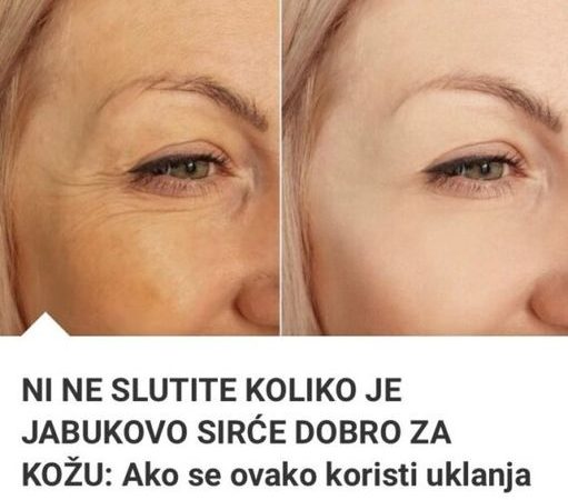 Ako Se 0vako Koristi Uklanja I Najdublje Bore Za Mjesec Dana!