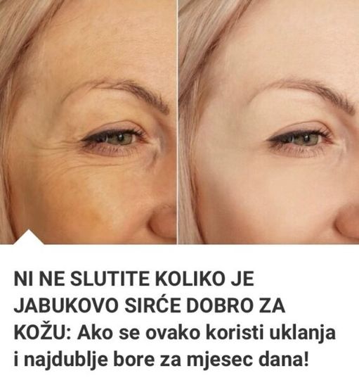 Ako Se 0vako Koristi Uklanja I Najdublje Bore Za Mjesec Dana!