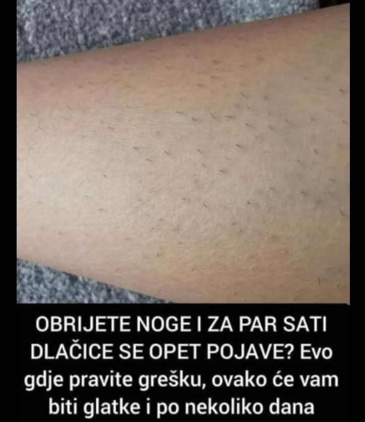 OBRIJETE NOGE I ZA PAR SATI DLAČICE SE OPET POJAVE? Evo gdje pravite grešku, ovako će vam biti glatke i po nekoliko dana