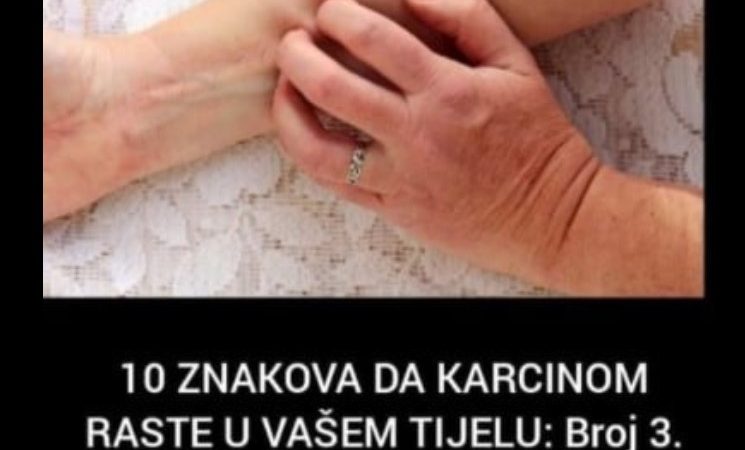 10 ZNAKOVA DA KARCINOM RASTE U VAŠEM TIJELU: Broj 3. svi zanemaruju, a to je znak za uzbunu!