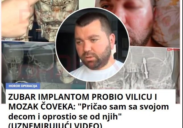 ZUBAR IMPLANTOM PROBIO VILICU I MOZAK ČOVEKA: “Pričao sam sa svojom decom i oprostio se od njih” (UZNEMIRUJUĆI VIDEO)