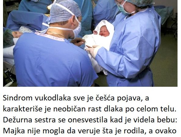 Dežurna sestra se onesvestila kad je videla bebu: Majka nije mogla da veruje šta je rodila, a ovako danas izgleda