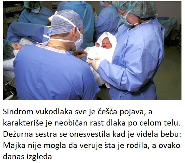 Dežurna sestra se onesvestila kad je videla bebu: Majka nije mogla da veruje šta je rodila, a ovako danas izgleda