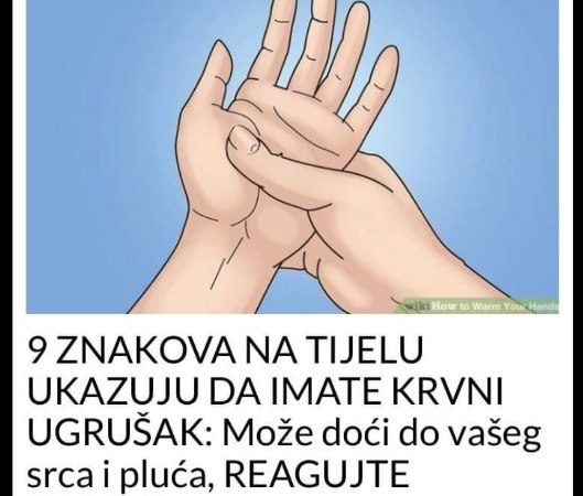 9 ZNAKOVA NA TIJELU UKAZUJU DA IMATE KRVNI UGRUŠAK: Može doći do vašeg srca i pluća, ODMAH REAGUJTE!