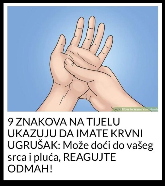 9 ZNAKOVA NA TIJELU UKAZUJU DA IMATE KRVNI UGRUŠAK: Može doći do vašeg srca i pluća, ODMAH REAGUJTE!