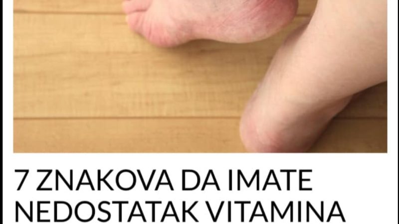 7 ZNAKOVA DA IMATE NEDOSTATAK VITAMINA “D”: Niste ni svjesni kako teško može da utiče na vaše zdravlje