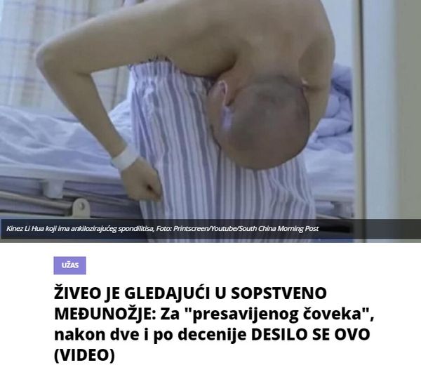 ŽIVEO JE GLEDAJUĆI U SOPSTVENO MEĐUNOŽJE: Za “presavijenog čoveka”, nakon dve i po decenije DESILO SE OVO (VIDEO)