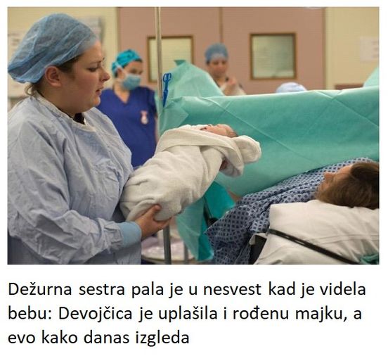 Dežurna sestra pala je u nesvest kad je videla bebu: Devojčica je uplašila i rođenu majku, a evo kako danas izgleda