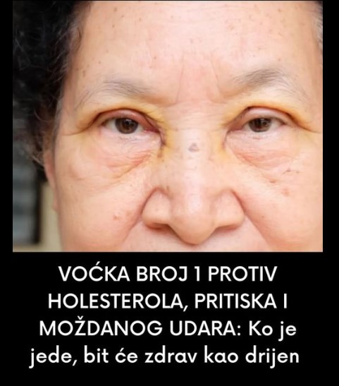 VOĆKA BROJ 1 PROTIV HOLESTEROLA, PRITISKA I MOŽDANOG UDARA: Ko je jede, zdrav je kao dren!