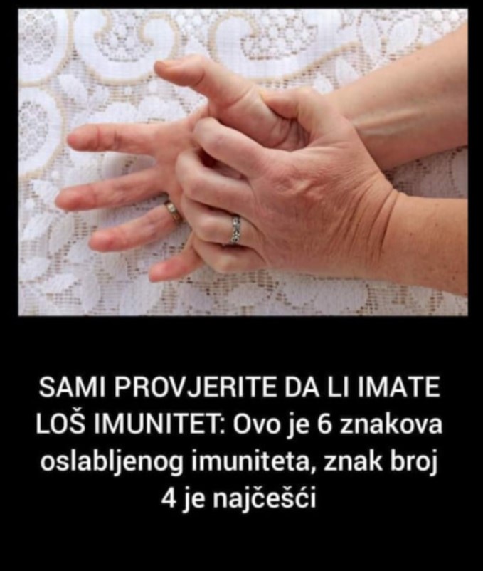 SAMI PROVJERITE DA LI IMATE LOŠ IMUNITET: Ovo je 6 znakova oslabljenog imuniteta, znak broj 4 je najčešći