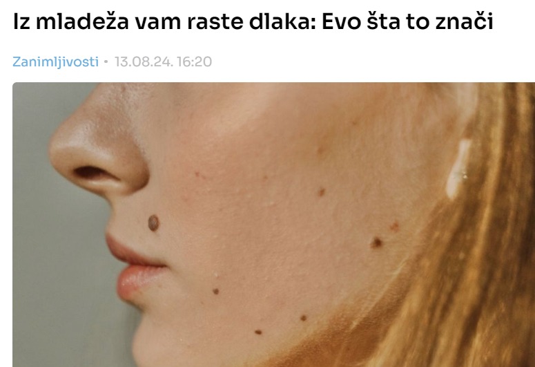 Iz mladeža vam raste dlaka: Evo šta to znači