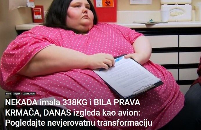 NEKADA imala 338KG i BILA PRAVA KRMAČA, DANAS izgleda kao avion: Pogledajte nevjerovatnu transformaciju ove djevojke