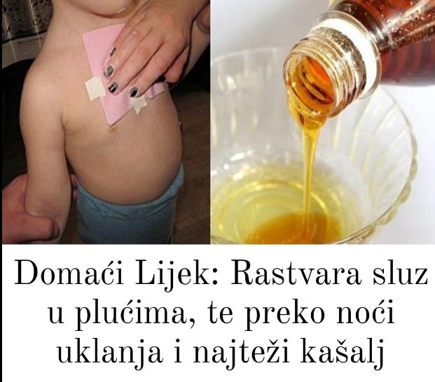 Domaći Lijek: Rastvara sluz u plućima, te preko noći uklanja i najtežI kašalj