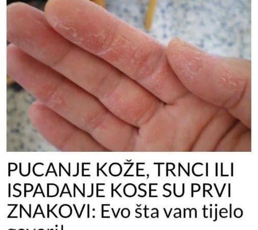 PUCANJE KOŽE, TRNCI ILI ISPADANJE KOSE SU PRVI ZNAKOVI: Evo šta vam tijelo govori!