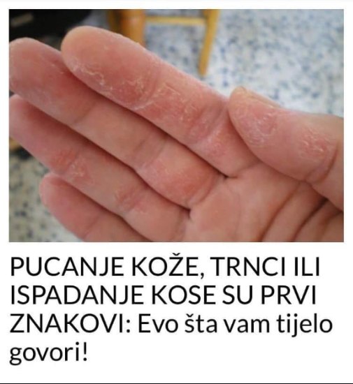 PUCANJE KOŽE, TRNCI ILI ISPADANJE KOSE SU PRVI ZNAKOVI: Evo šta vam tijelo govori!