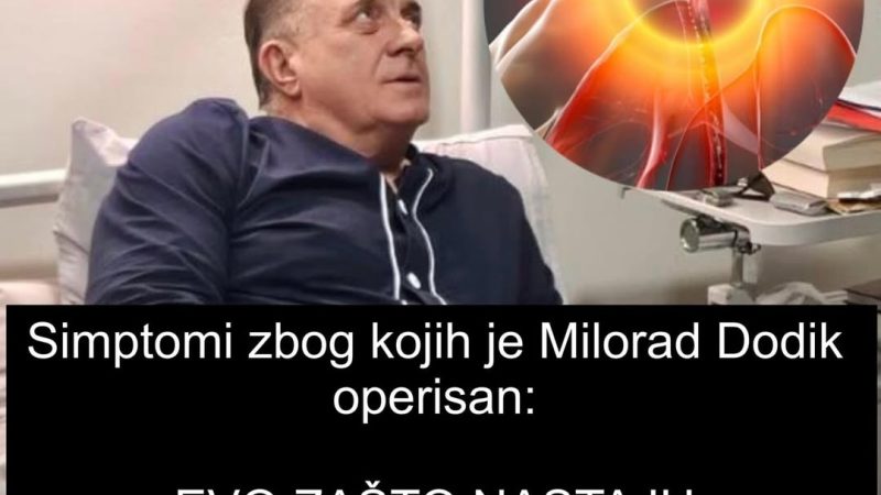 Simptomi zbog kojih je Milorad Dodik operisan: EVO ZAŠTO NASTAJU OVI BOLOVI