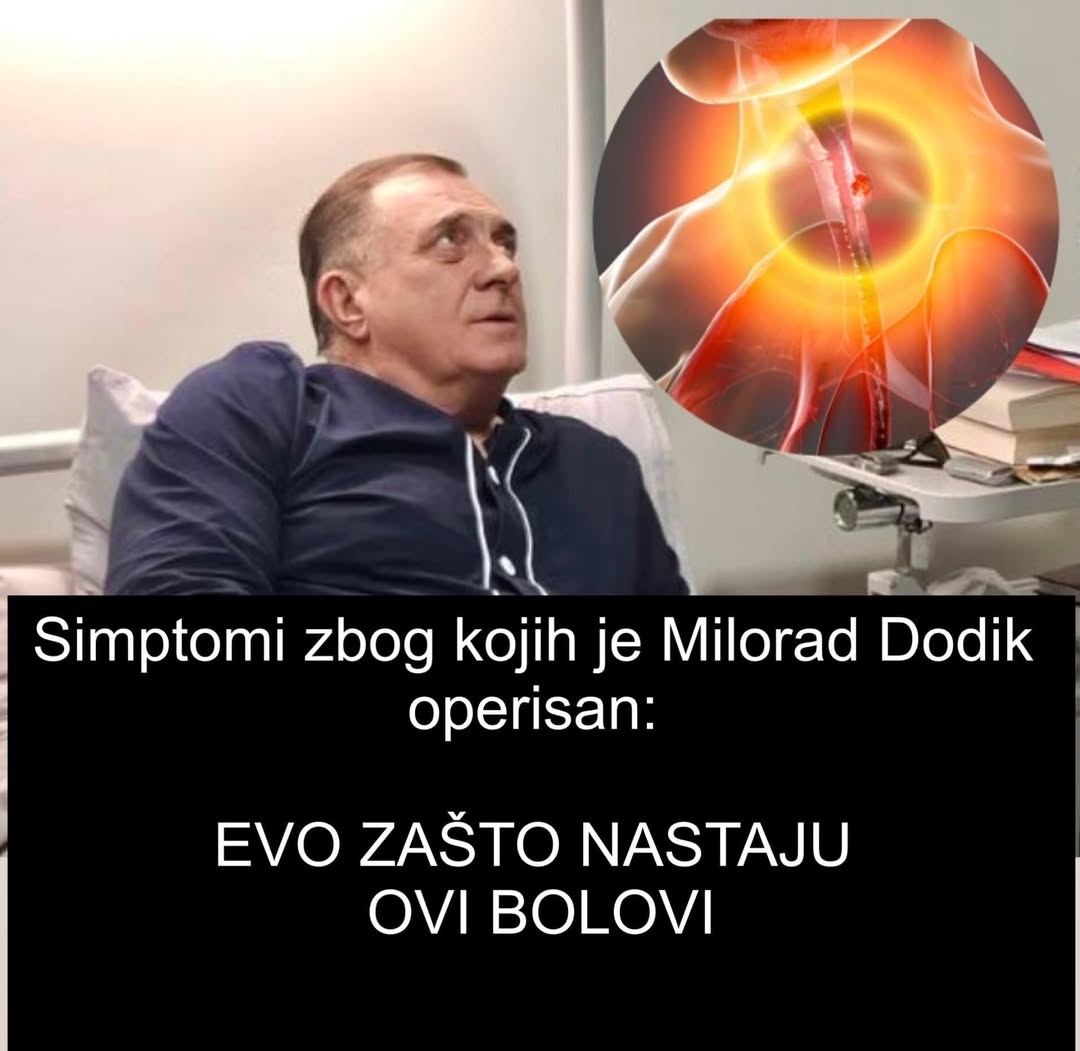 Simptomi zbog kojih je Milorad Dodik operisan: EVO ZAŠTO NASTAJU OVI BOLOVI