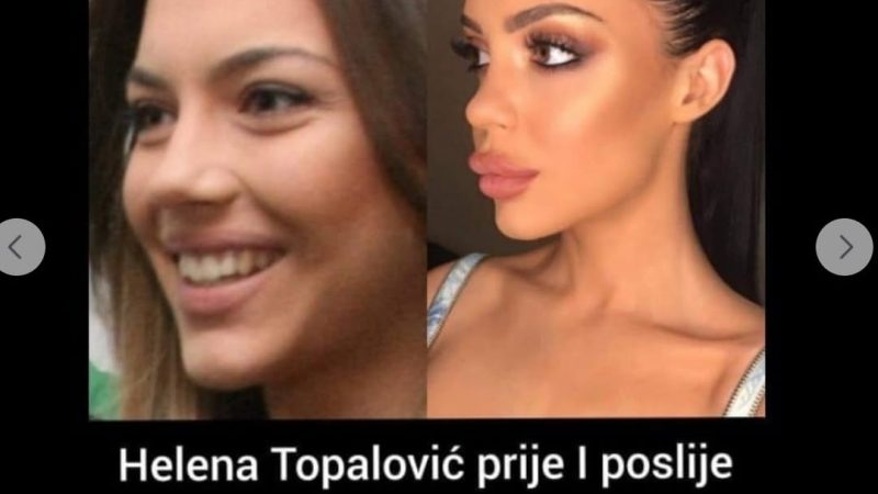 OVO JE TOPALKOVA KĆERKA PRIJE PLASTIČNIH OPERACIJA: Ali čekajte da vidite lice ALEKSANDRE PRIJOVIĆ!